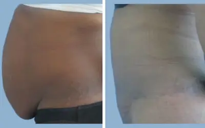 Before and After